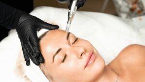 Read more about the article Microneedling Showdown: Comparing RF, Ultrasound Assisted, and Traditional Techniques