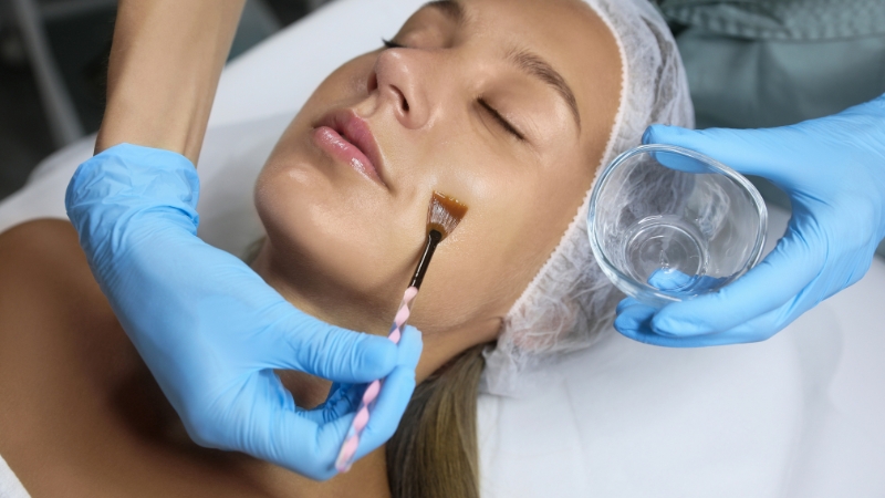 Woman in a clinic receiving a facial chemical peel treatment with a brush