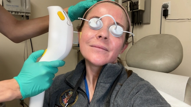 IPL treatment suitability assessment during a facial session with protective eye shields