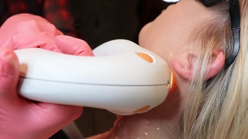 Intense Pulsed Light (IPL) Treatment targets facial redness and visible blood vessels during a clinical session