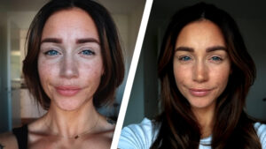 Read more about the article Top 6 Aesthetic Treatments with the Best Before and After Transformations