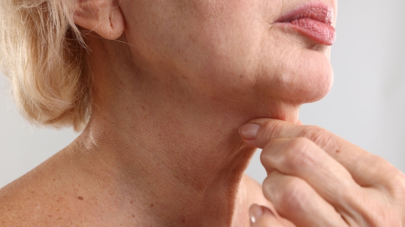 Older woman examining loose neck skin while considering the ideal age for a neck lift
