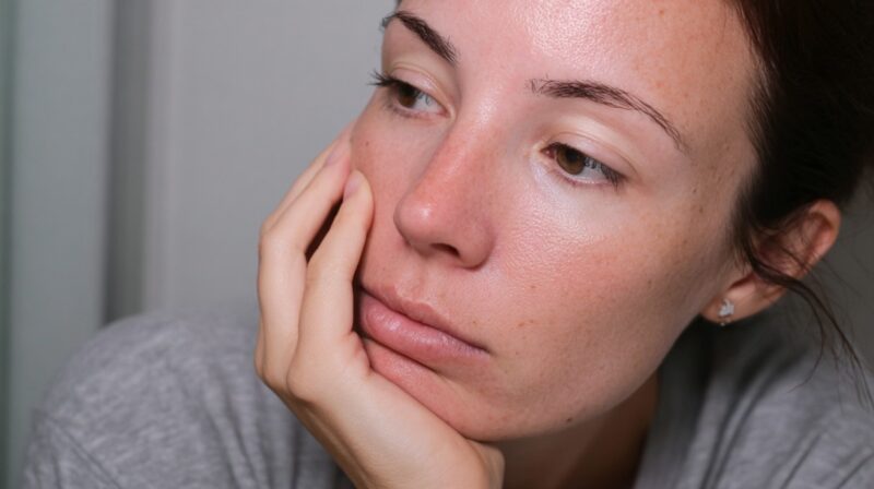 Person resting their face on their hand with mild facial redness
