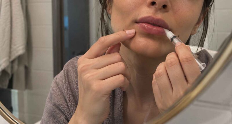 Woman attempting DIY lip filler injection at home.